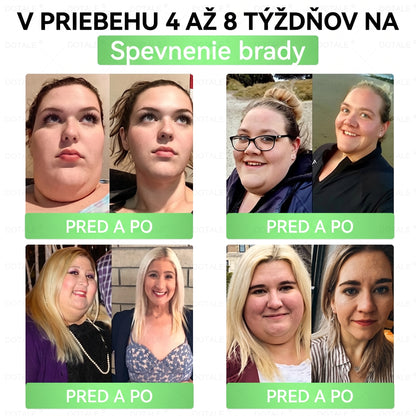 𝑫𝑶𝑻𝑨𝑳𝑬® 𝑴𝒆𝒕𝒂𝒃𝒐𝒍𝒊𝒄 𝑵𝒂𝒏𝒐 𝑴𝒊𝒄𝒓𝒐𝒏𝒆𝒆𝒅𝒍𝒆 𝑷𝒂𝒕𝒄𝒉 🇸🇰 (𝐈𝐛𝐚 𝐫𝐚𝐳 𝐝𝐞𝐧𝐧𝐞, 𝐯𝐢𝐝𝐢𝐭𝐞ľ𝐧é 𝐳𝐦𝐞𝐧𝐲 𝐮ž 𝐳𝐚 𝟕 𝐝𝐧í) 𝘽𝙚𝙧𝙗𝙚𝙧í𝙣 + 𝙈𝙤𝙧𝙞𝙣𝙜𝙖 𝙁𝙤𝙧𝙢𝙪𝙡𝙖 ✅ 𝐏𝐫𝐞 𝐨𝐛𝐞𝐳𝐢𝐭𝐮, 𝐨𝐜𝐡𝐚𝐛𝐧𝐮𝐭ú 𝐩𝐨𝐤𝐨ž𝐤𝐮, 𝐜𝐮𝐤𝐫𝐨𝐯𝐤𝐮, 𝐬𝐩á𝐧𝐤𝐨𝐯é 𝐚𝐩𝐧𝐨𝐞, 𝐩𝐫𝐨𝐛𝐥é𝐦𝐲 𝐬 𝐤ĺ𝐛𝐦𝐢 𝐚 𝐦𝐧𝐨𝐡𝐨 𝐝𝐚𝐥š𝐢𝐞𝐡𝐨 💥💥